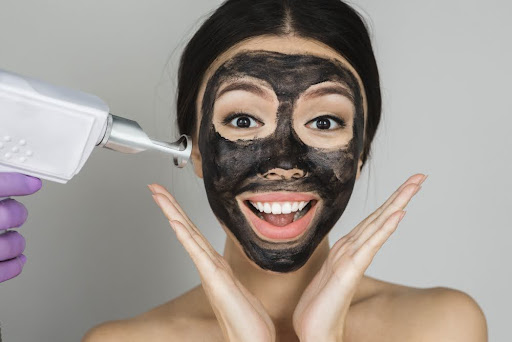 Benefits of a carbon peel procedure.
